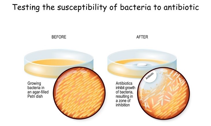 抗菌作用のスクリーニング　４．抗菌作用とグネチンC