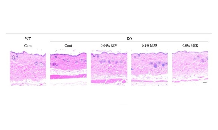 論文中の皮膚の厚み画像　９．抗酸化とグネチンC