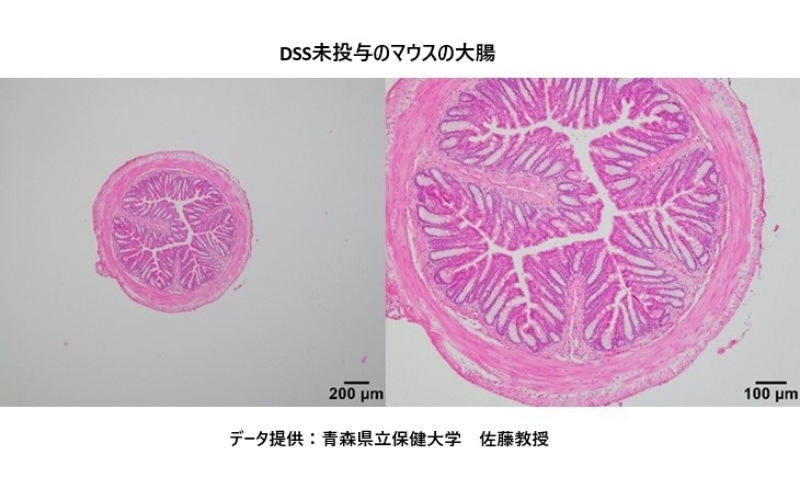 DSS未投与のコントール群の大腸切片