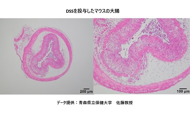 DSSを投与した試験群の大腸切片